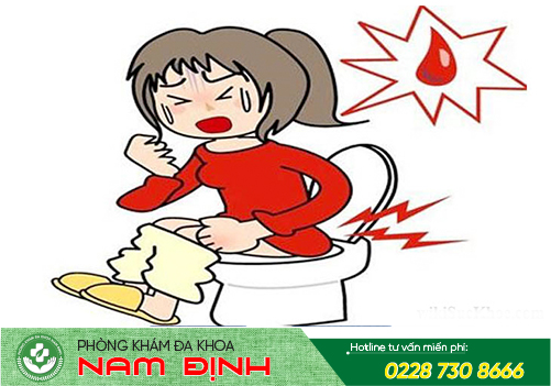 trĩ hỗn hợp trĩ hỗn hợp