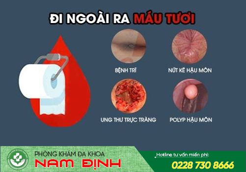 đi ngoài ra máu đi ngoài ra máu