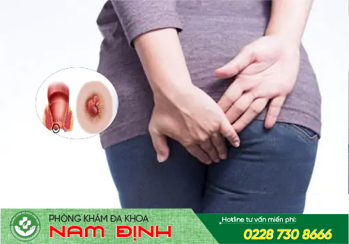 mụn hậu môn